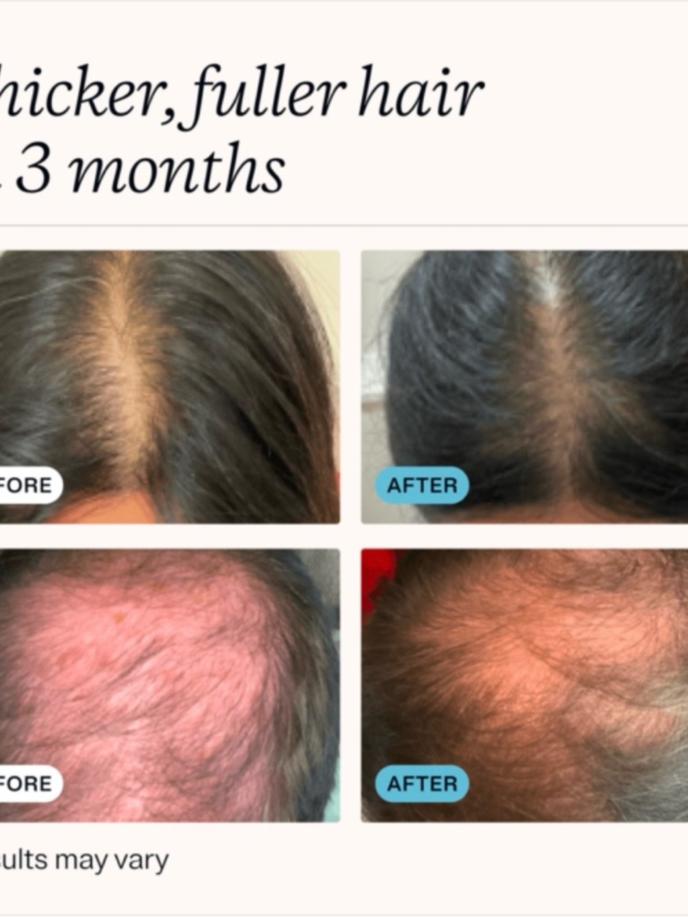 MD Hair Restore Customized Shampoo - Picture 3 of 8